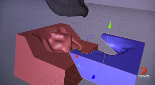 3d打印假耳 助力耳朵傷殘兒童恢復聽力
3D打印耳朵,3D打印假耳,上海3d打印店,上海3d打印公司,上海3d打印展覽會,上海3d打印展,上海3d打印園區,上海3d打印專用瞬間膠jls020,上海3d打印樓房,上海3d打印企業,上海3d打印展會,上海3d打印展覽,上海3D打印