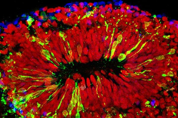 科學家攻克Zika病毒 高中生攜3D打印來幫忙

Zika病毒,3D打印醫療行業,3D打印材料價格,3D打印技術,3D打印材料,3D打印成本,3D打印價格