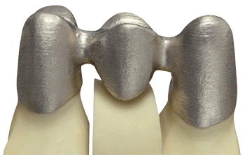 德國率先引入3D打印牙齒技術 全程體驗“無痛”種牙-e鍵打印|3D打印服務
3d打印牙齒,3D打印種牙,無痛種牙,3D打印平臺,3D打印服務,南京哪里有3D打印,南京3D打印廠家,南京3D打印服務