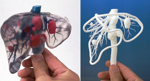 個性化醫療3D打印實戰案例與研究成果的問答整理_3d打印服務公司 個性化醫療3D打印實戰案例與研究成果的問答整理_3d打印服務公司