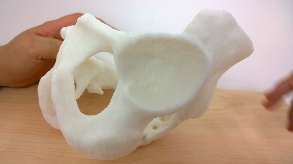 3d打印應用領域之醫療應用_e鍵打印服務公司 3d打印應用領域之醫療應用_e鍵打印服務公司