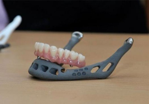 醫(yī)療3D打印的假牙 新手選擇3D打印手板模型加工打樣還是CNC加工?選擇當(dāng)?shù)剡€是全國3D打印公司?