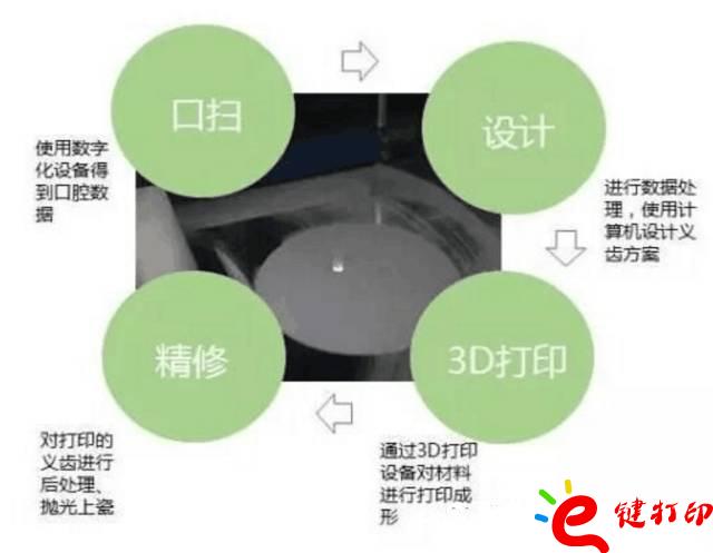 醫療輔助器械的變革之路 3d打印義齒(假牙)前景無限 勢在必行_醫療設備器械3d模型打印平臺 醫療輔助器械的變革之路 3d打印義齒(假牙)前景無限 勢在必行_醫療設備器械3d模型打印平臺