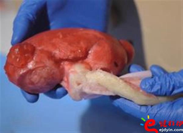 [3d打印醫療]醫生手術磨刀石 仿生3D打印心臟及人體器官