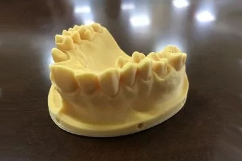 口腔齒科牙科領域的3D打印應用現(xiàn)狀