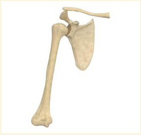 肩關節金屬植入物3